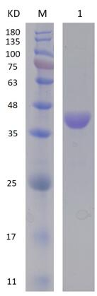 12% SDS-PAGE analysis profiles of purified PA0041-161-514 (CBB stained).